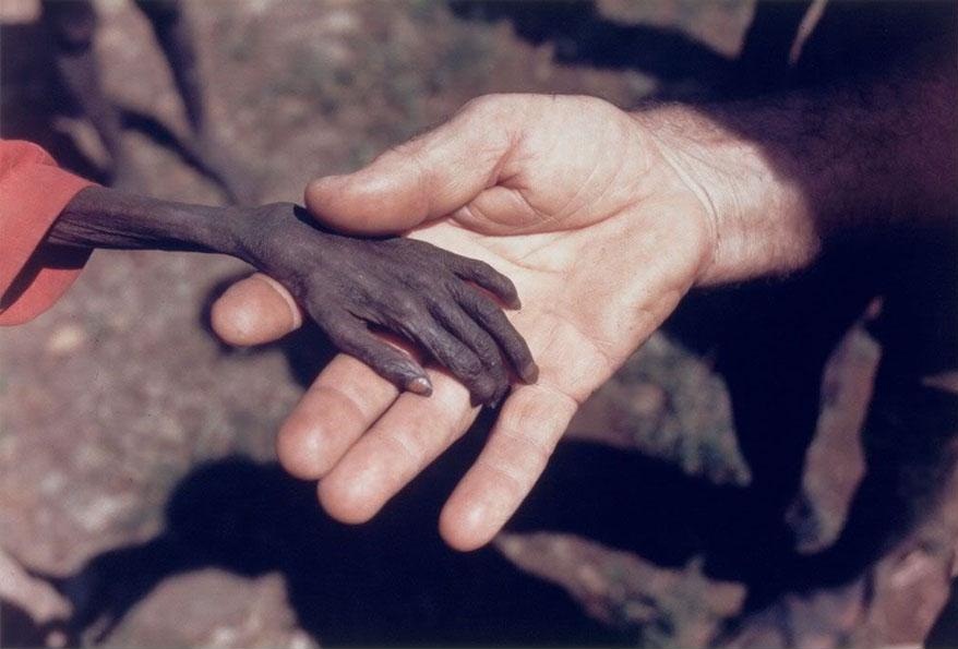 A Starving Boy and Missionary